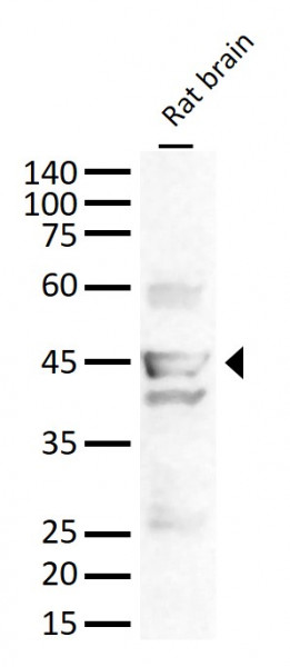 Anti-CNP