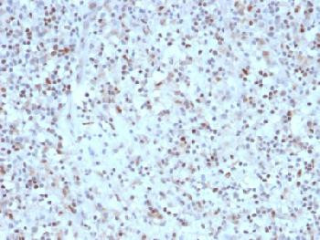 Anti-Bcl-6 (Follicular Lymphoma Marker) Recombinant Mouse Monoclonal Antibody (clone:rBCL6/1527)