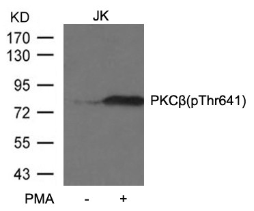 Anti-phospho-PKC beta (Thr641)