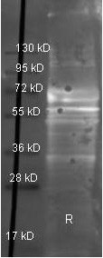 Anti-Fibrinogen (human plasma)