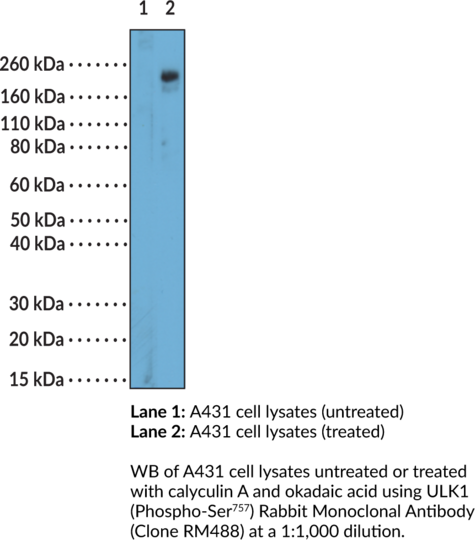 Anti-ULK1 (Phospho-Ser757) Rabbit (Clone RM48