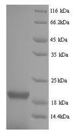 Nucleoprotein (NP), partial, Influenza B virus, recombinant