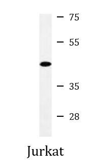 Anti-TRH Receptor