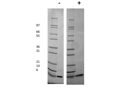 Insulin-like Growth Factor I