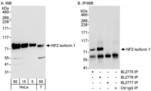 Anti-NF2