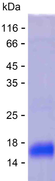 Recombinant Human TXNDC16 Protein