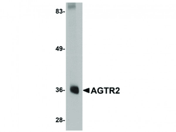 Anti-AGTR2