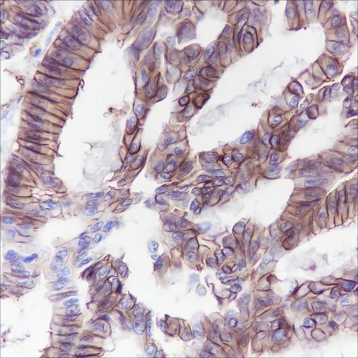 Anti-Recombinant Cadherin-17, clone A111