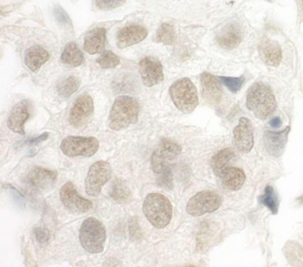 Anti-FOXP1 (IHC)