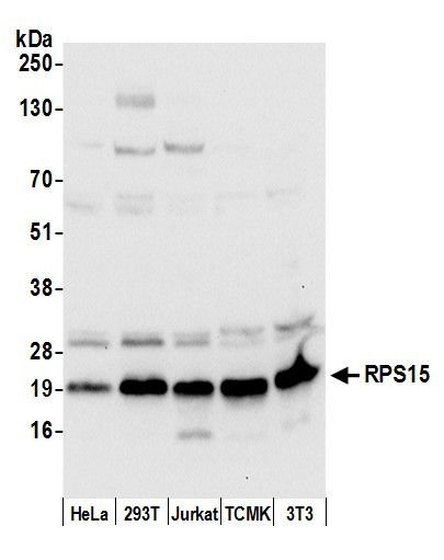 AntiRPS15/Ribosomal Protein S15 Bethyl Laboratories Biomol.de