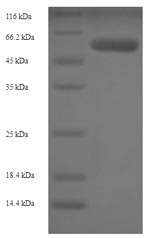 Adenosylhomocysteinase (AHCY), human, recombinant
