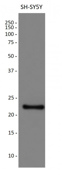 Anti-GPX1