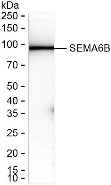 Anti-SEMA6B