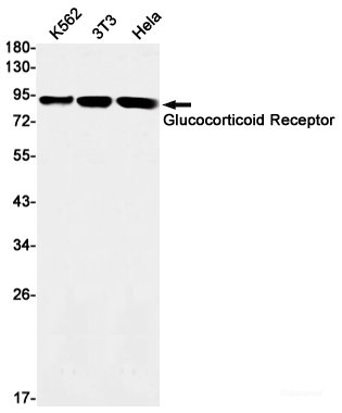 Anti-Recombinant Glucocorticoid Receptor, clone R04-8C8