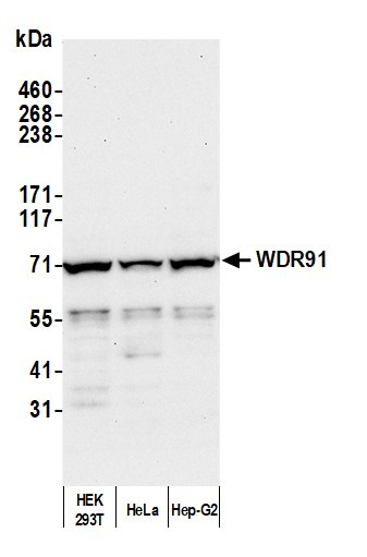 Anti-WDR91