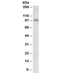 Anti-Aryl Hydrocarbon Receptor