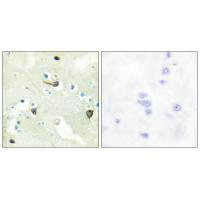 Anti-EPHB1/EPHB2/EPHB3