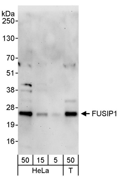 Anti-FUSIP1