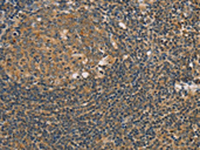 Anti-PARP11