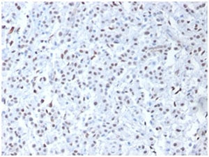 Anti-WT1 / Wilms Tumor 1