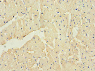 Anti-TTC32