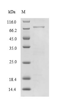Myelin-associated glycoprotein (MAG), partial, human, recombinant