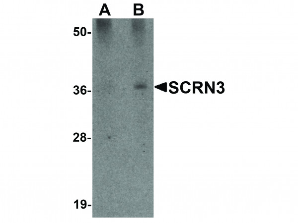 Anti-SCRN3