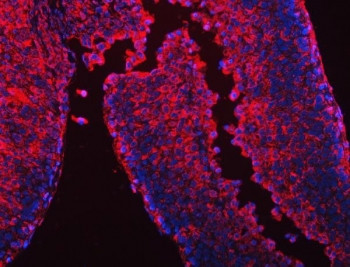 Anti-CES2 / Carboxylesterase 2