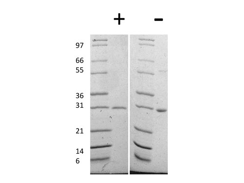 Galectin-3