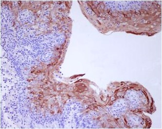 Anti-Involucrin