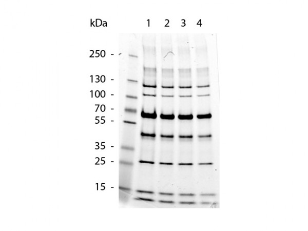 glutathione peroxidase oxidative stress Glutathione