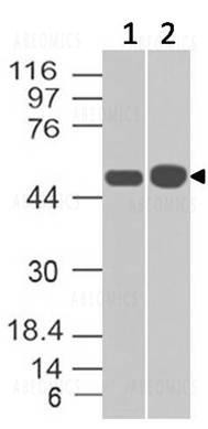 Anti-Antitrypsin (Clone: ABM48F6)