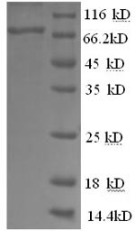 Alpha-fetoprotein (Afp), mouse, recombinant