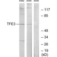Anti-TFE3