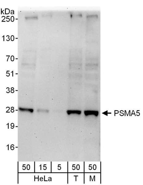 Anti-PSMA5