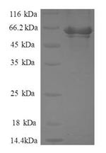 Activator of 90 kDa heat shock protein ATPase homolog 1 (AHSA1), human, recombinant