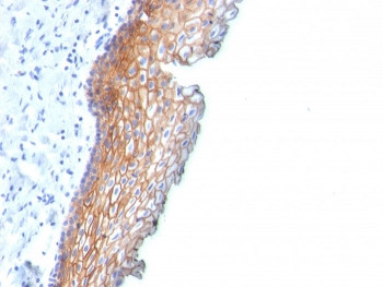 Anti-Desmoglein 3 / DSG3, clone DSG3/2838