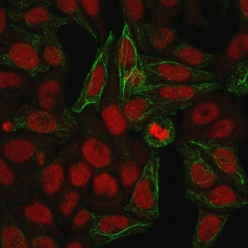 Anti-KRT7 / Cytokeratin 7, clone KRT7/903