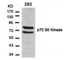 Anti-p70 S6 Kinase (Ab-424)