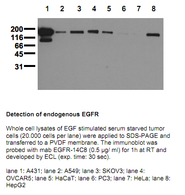 Anti-EGF Receptor (N-term), clone 14C8
