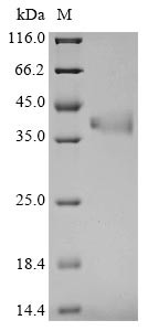 Fructose-bisphosphate aldolase C (Aldoc), mouse, recombinant
