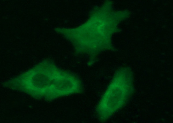 Anti-Complexin-2/CPLX2 Monoclonal Recombinant Antibody