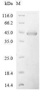 Desert hedgehog protein (DHH), partial, human, recombinant