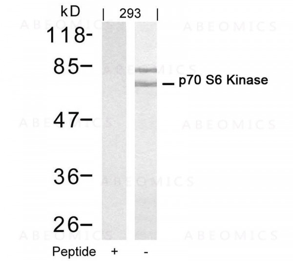 Anti-p70 S6 Kinase (Ab-421)
