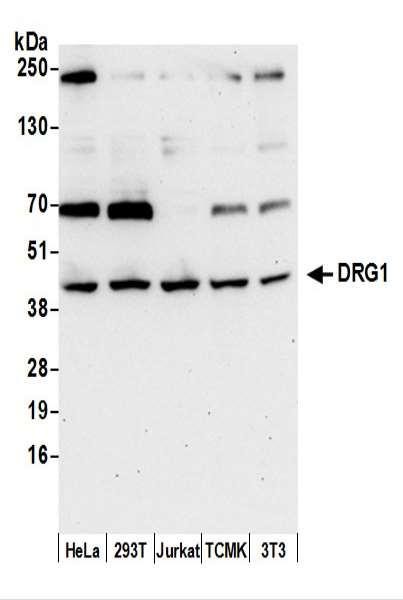 Anti-DRG1