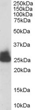 Anti-Triosephosphate isomerase, C-terminal