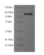 Protein RMD5 homolog A (RMND5A), human, recombinant