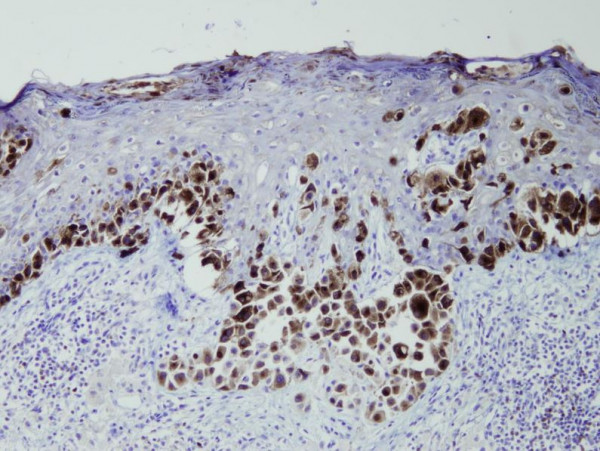 Anti-Melanoma (gp100), clone P14-V