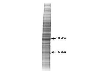 A431 Whole Cell Lysate Whole Cell Lysate, 1.0 mg/ml by BCA assay, in 1X SDS-PAGE Sample Buffer