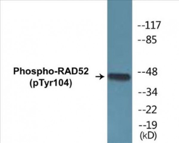 RAD52 (Phospho-Tyr104) Colorimetric Cell-Based ELISA Kit